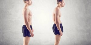 Κύφωση - Physio4u